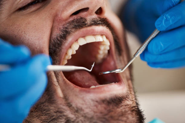 Best Broken or Cracked Tooth Emergency Dentist in Glendale, OH
